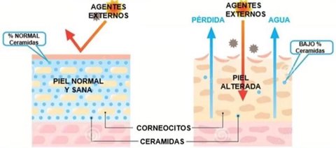 ceramidas queson