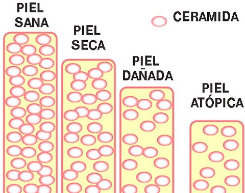 ceramidas