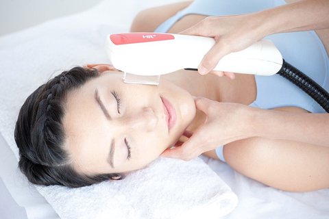 fotofacial 1