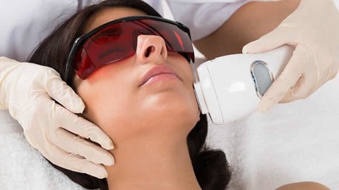 cuidados posteriores a un láser fotofacial