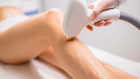 ¿ me puedo depilar con láser en verano?