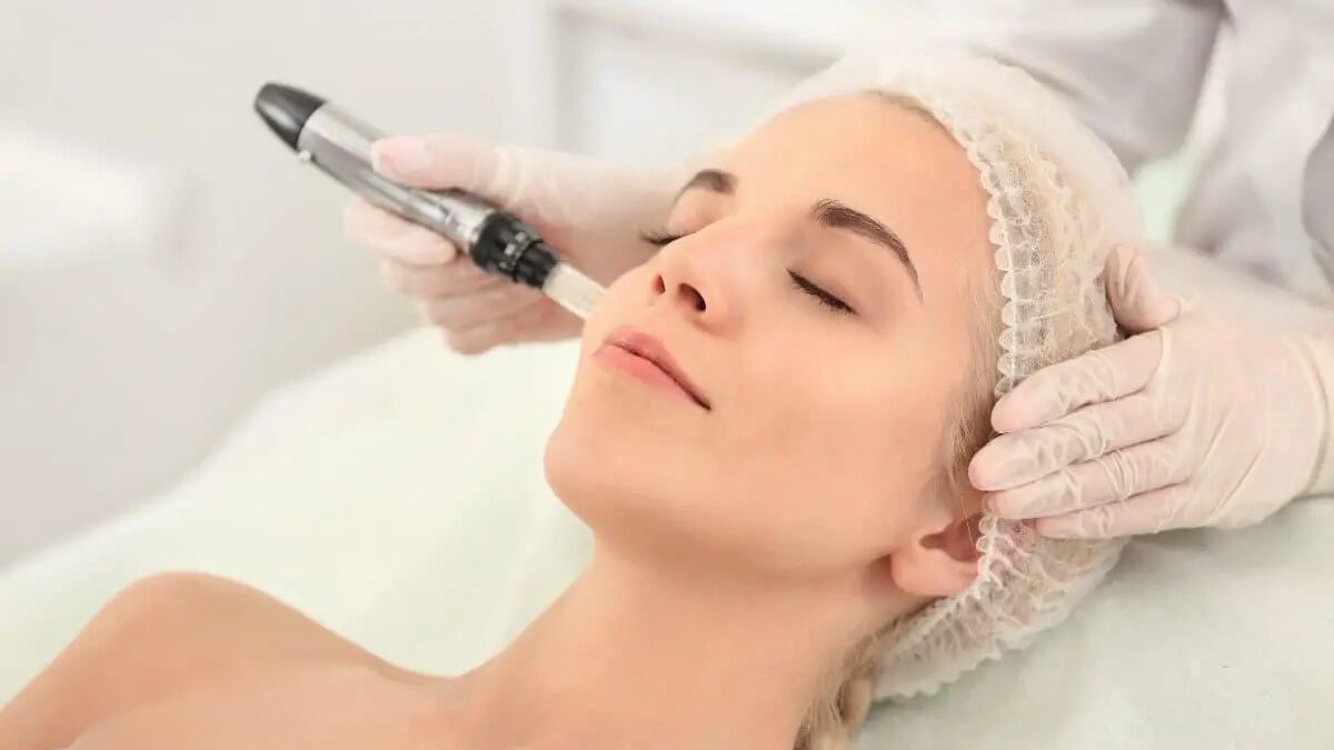 eliminar marcas acne