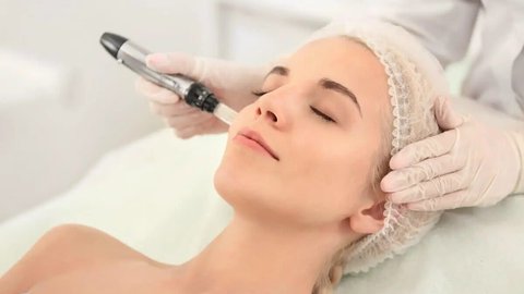 eliminar marcas acne