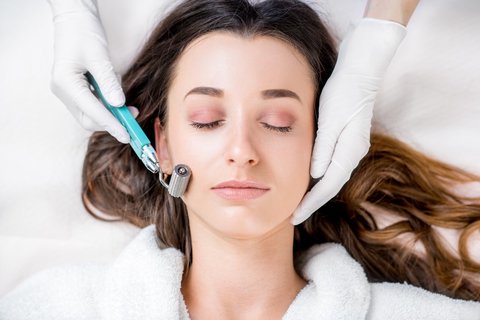 microneedling acne