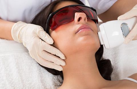 piel despues primera sesion laser rostro