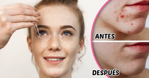 beneficios retinol