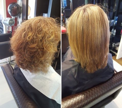 taninoplastia antes y despues