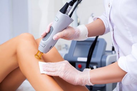 depilacion laser