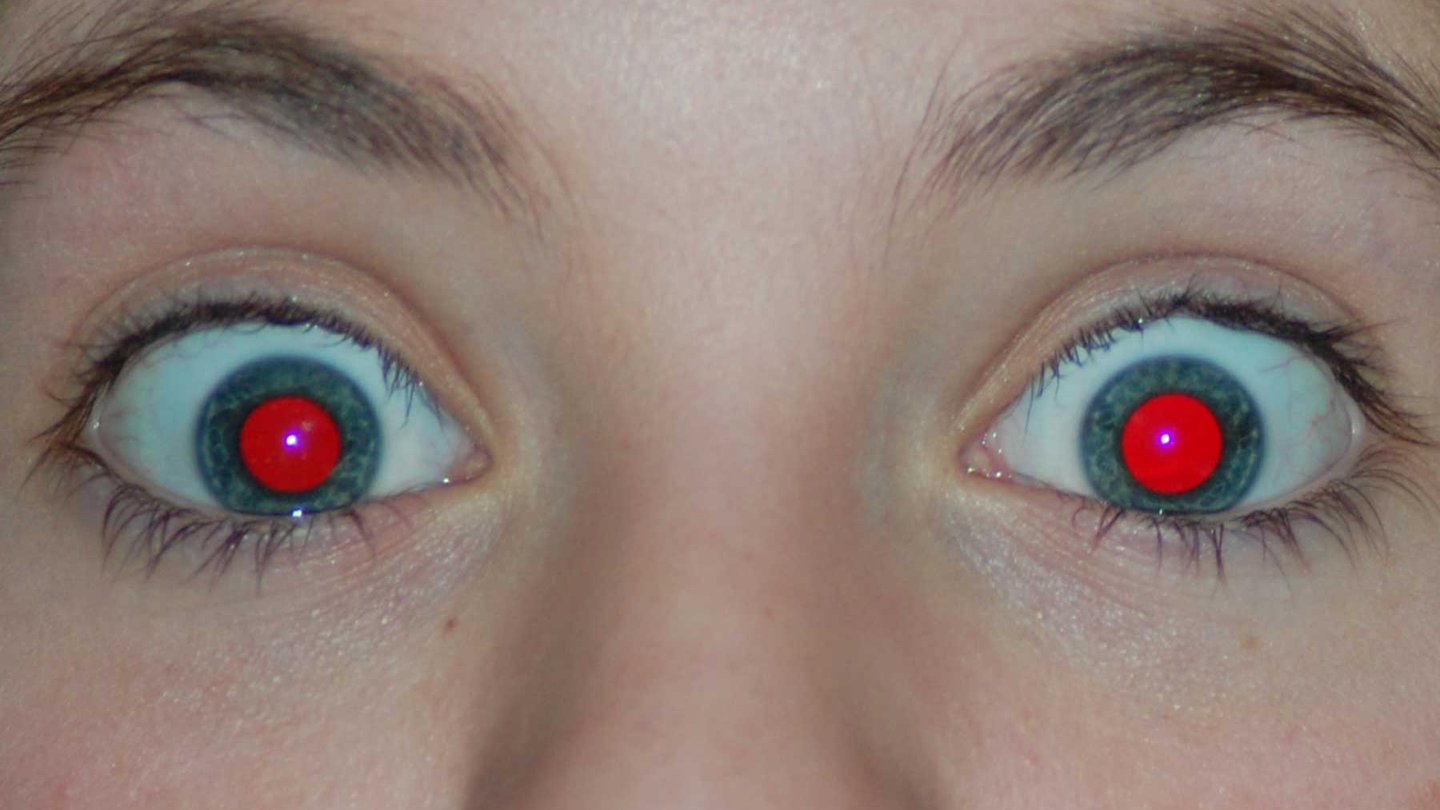 que causa ojos rojos fotografias