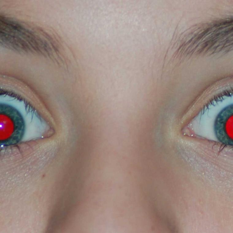 que causa ojos rojos fotografias