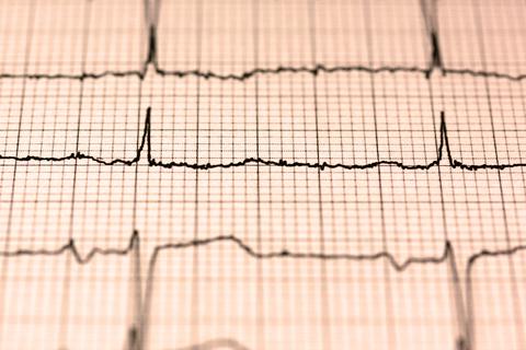 como frecuencia cardiaca reposo indica salud