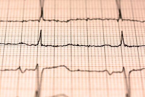 como frecuencia cardiaca reposo indica salud