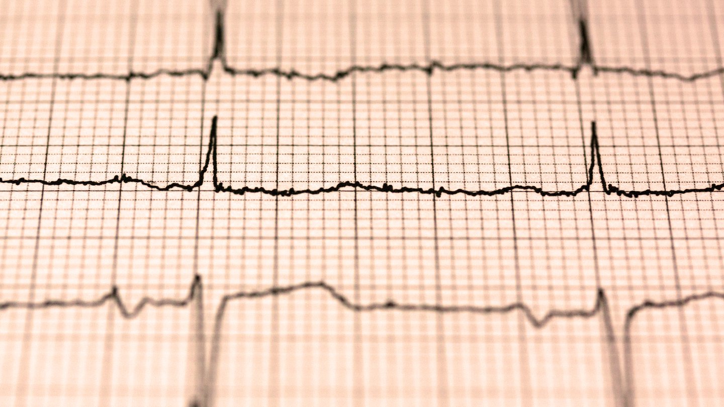como frecuencia cardiaca reposo indica salud