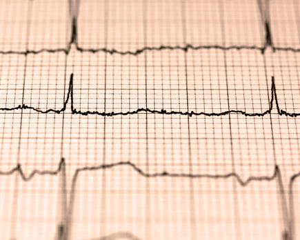 como frecuencia cardiaca reposo indica salud