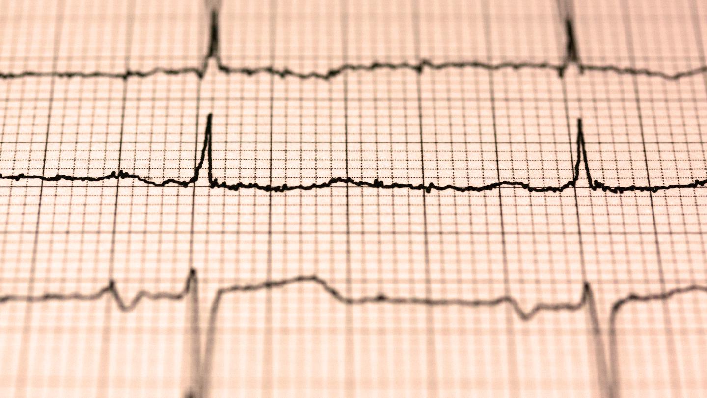 como frecuencia cardiaca reposo indica salud