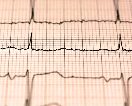 la frecuencia cardiaca en reposo puede reflejar nuestra salud actual y futura