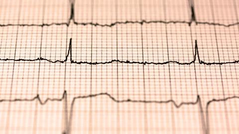 la frecuencia cardiaca en reposo puede reflejar nuestra salud actual y futura