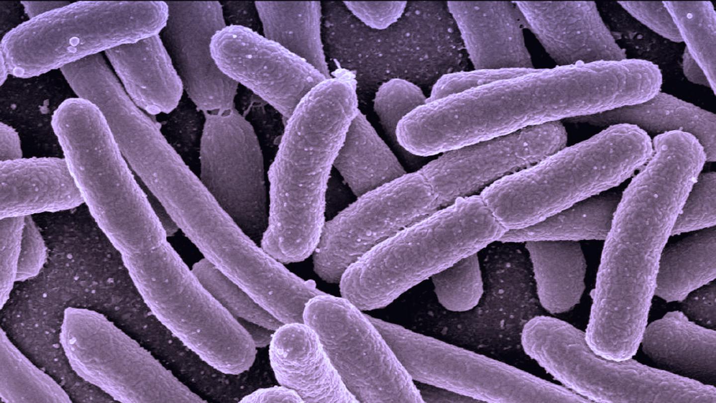 cual es la diferencia entre infecciones viricas y bacterianas