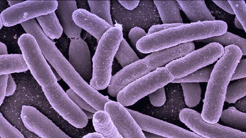 cual es la diferencia entre infecciones viricas y bacterianas