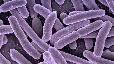 cual es la diferencia entre infecciones viricas y bacterianas