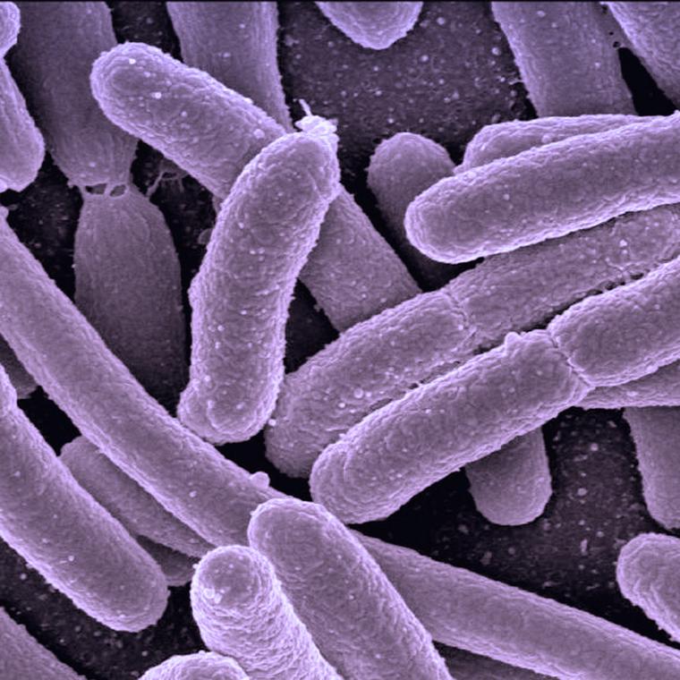 cual es la diferencia entre infecciones viricas y bacterianas