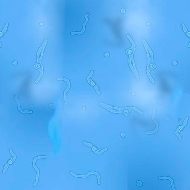 que causa las moscas volantes o miodesopsias