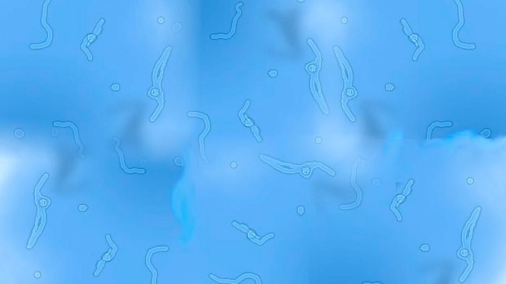 que causa las moscas volantes o miodesopsias