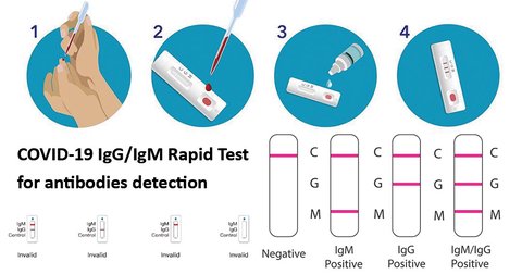ejemplo de resultados de un test igm igg