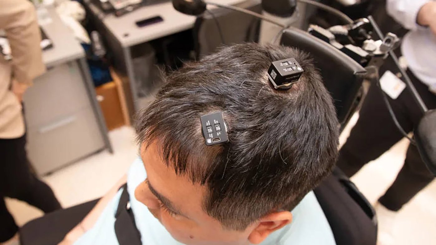 implantes cerebrales basados ia ayudan hombre paralitico a moverse