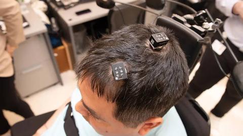 implantes cerebrales basados ia ayudan hombre paralitico a moverse