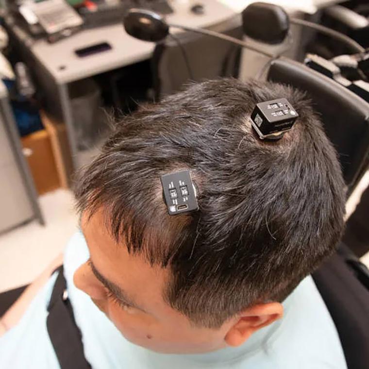 implantes cerebrales basados ia ayudan hombre paralitico a moverse